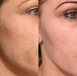 Rose Gold Face Serum