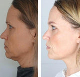 Intensive Anti-Aging Night Cream